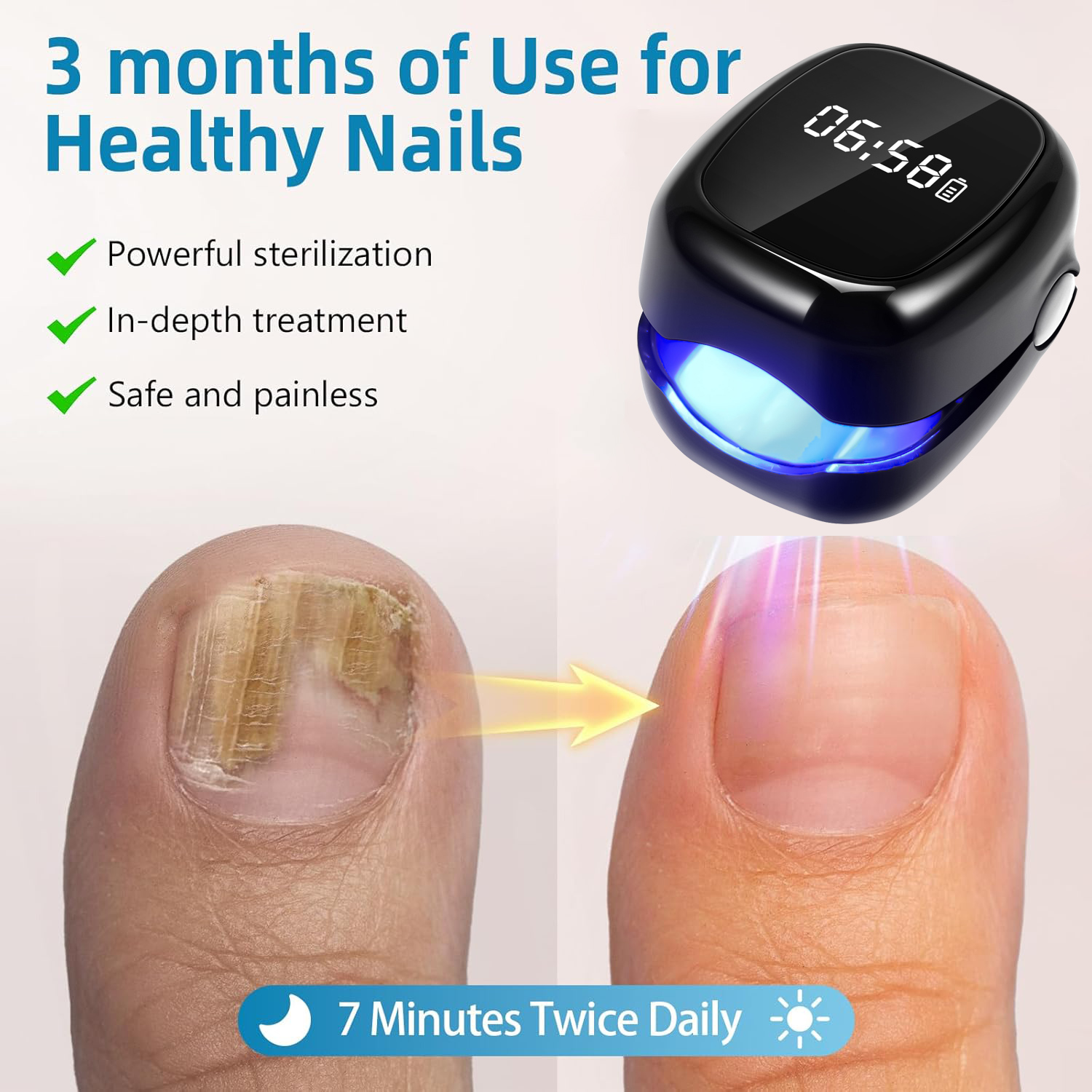 UV Laser Nail Fungus Removal D – обзор и цена Industrial Laser Removal