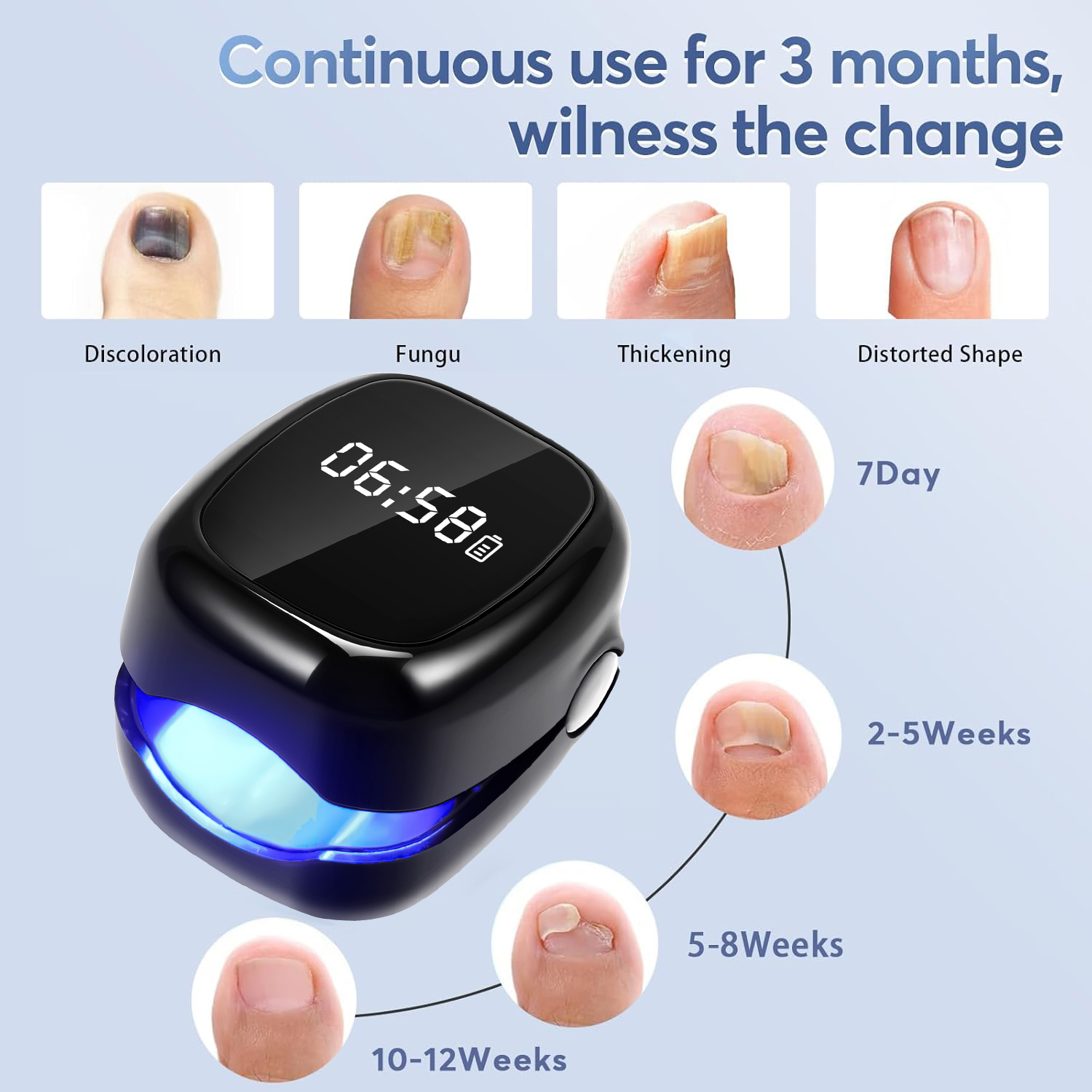 UV Laser Nail Fungus Removal D – обзор и цена Industrial Laser Removal