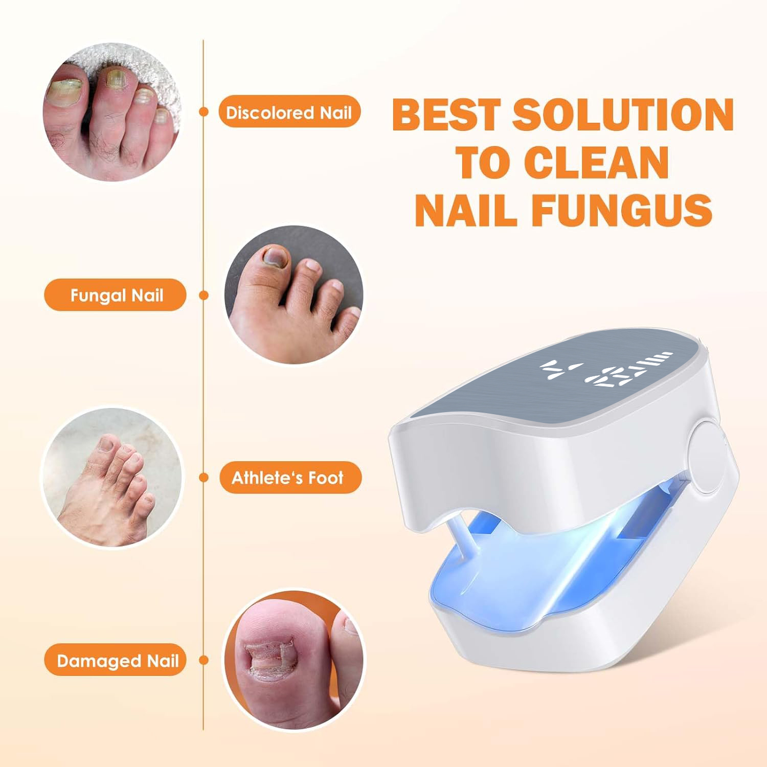 1pcs Effective Rechargeable Na – обзор и цена Industrial Laser Removal
