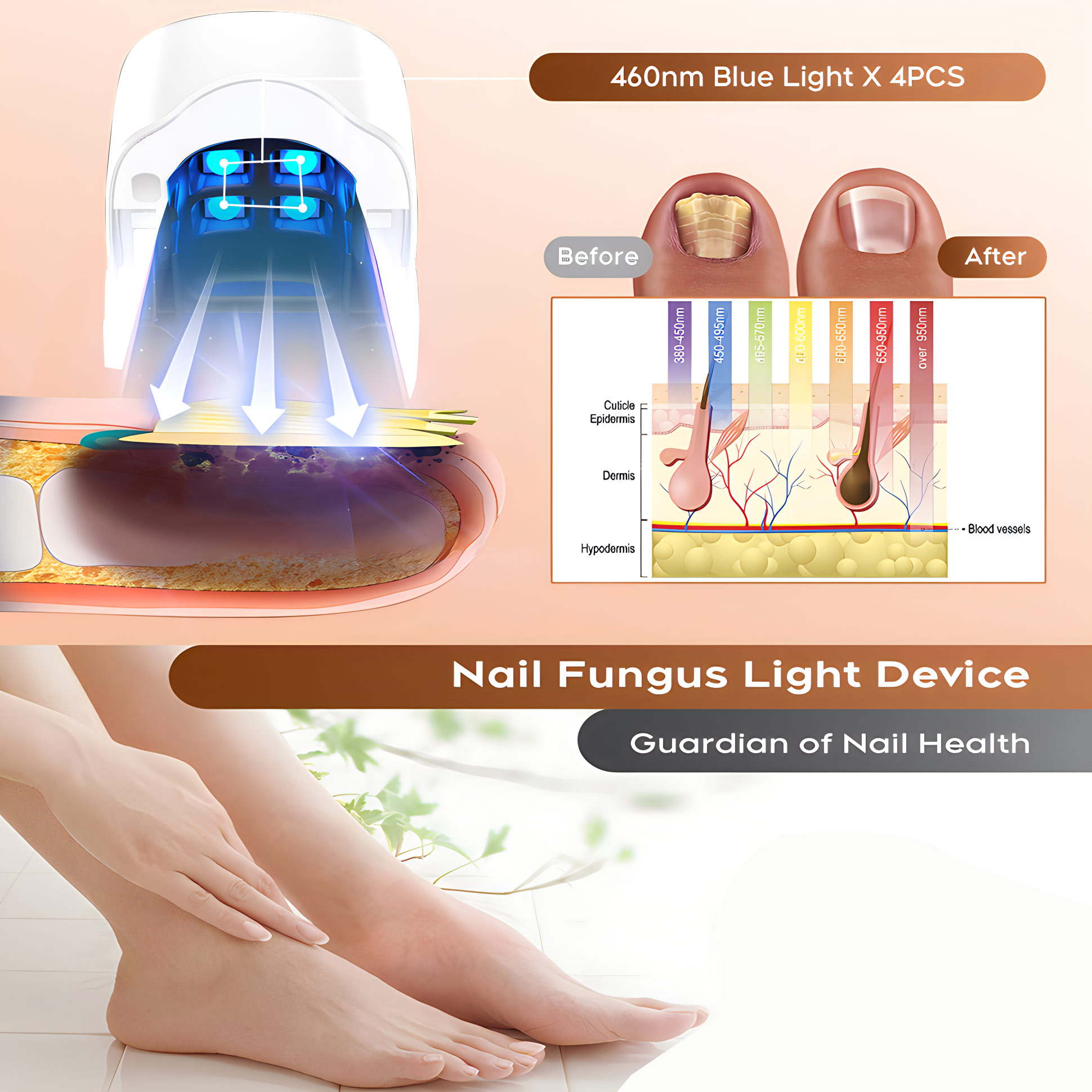Nail Fungus Laser Assist Tool  – обзор и цена Industrial Laser Removal